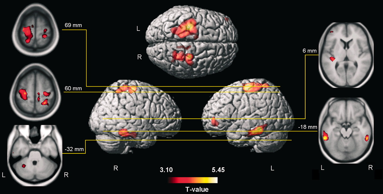 Musical Training: A Workout For Your Brain!