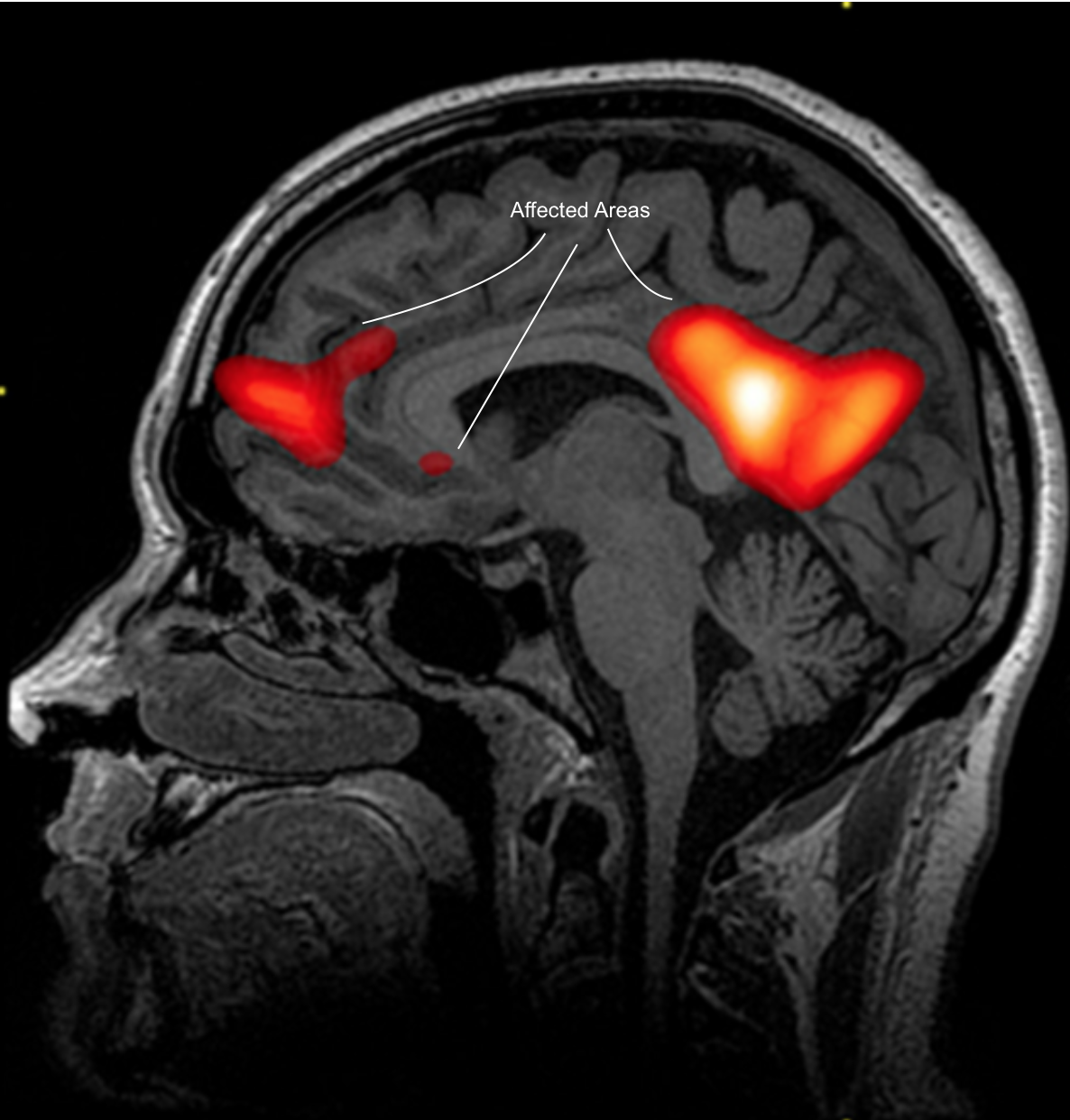 Love: A Social Construct or Just Science?