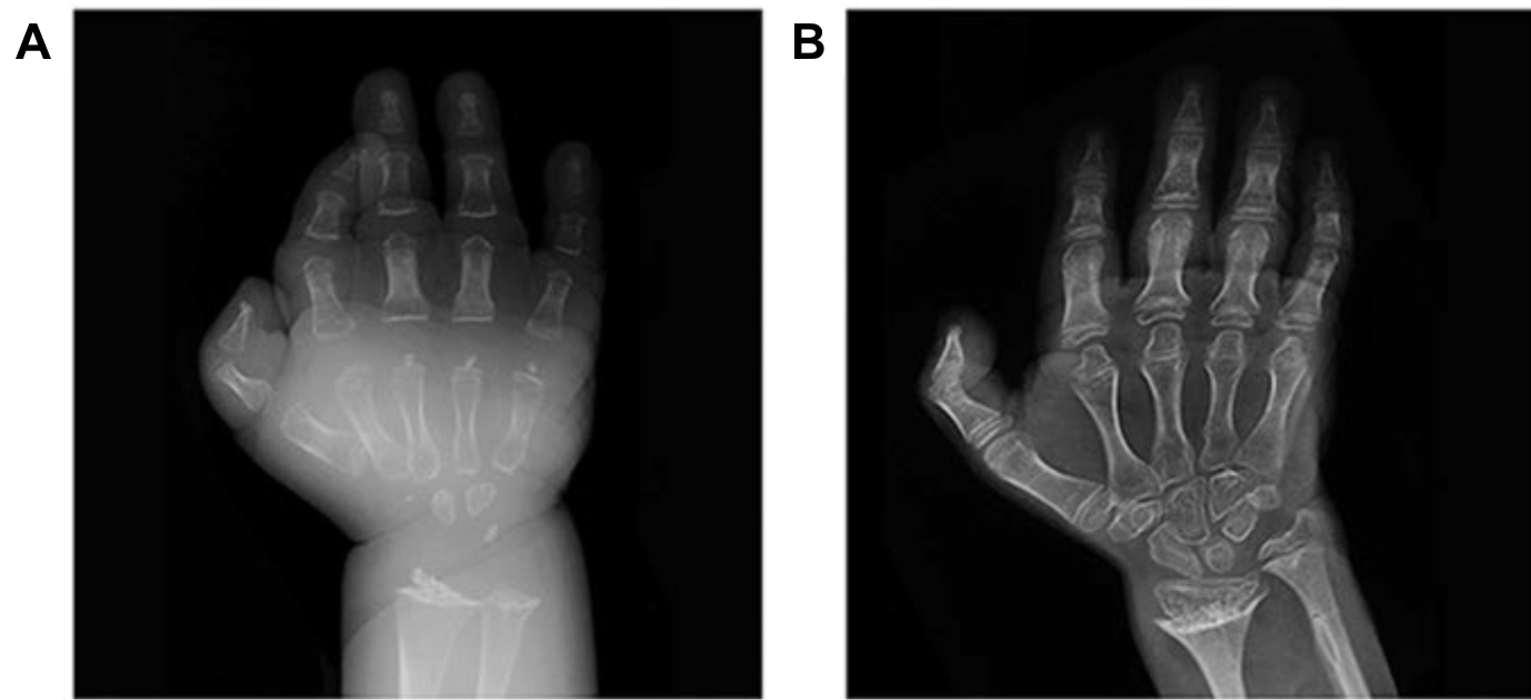 Misdiagnosis of Physical Illnesses as Mental Disorders