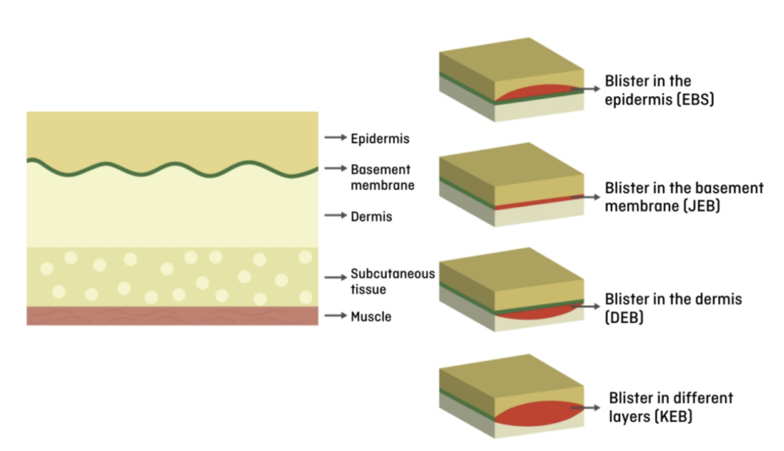 The Worst Disease You’ve Never Heard Of