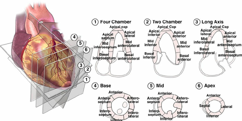 The Dangers of A Broken Heart: “Takotsubo” Syndrome