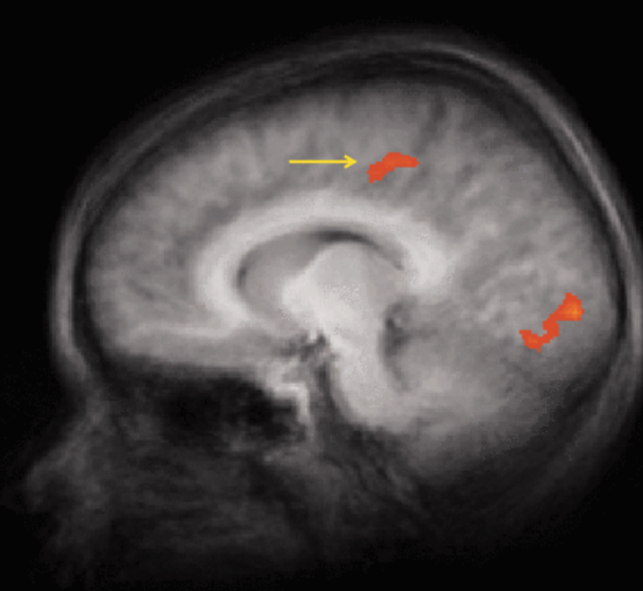 Preferences and Product Positioning