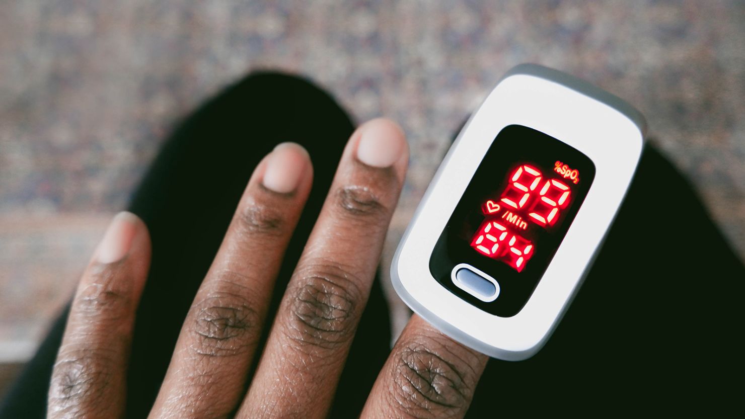 Skin Pigmentation Bias in Pulse Oximetry Measurements
